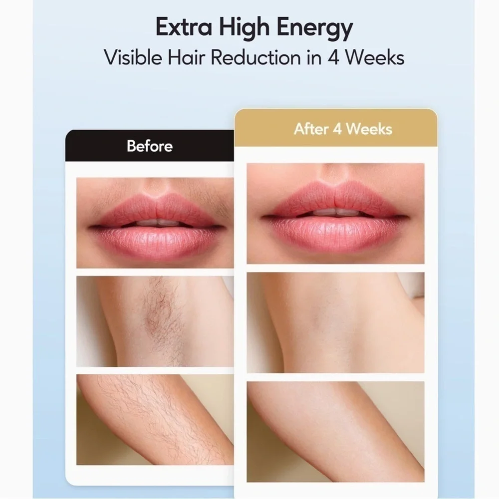 IPL Hair Removal with Ice Cooling Care Function Permanent 999k flashes #A5